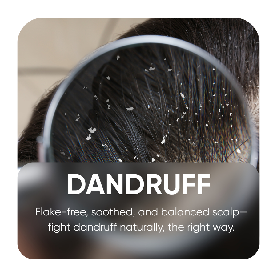 Dandruff