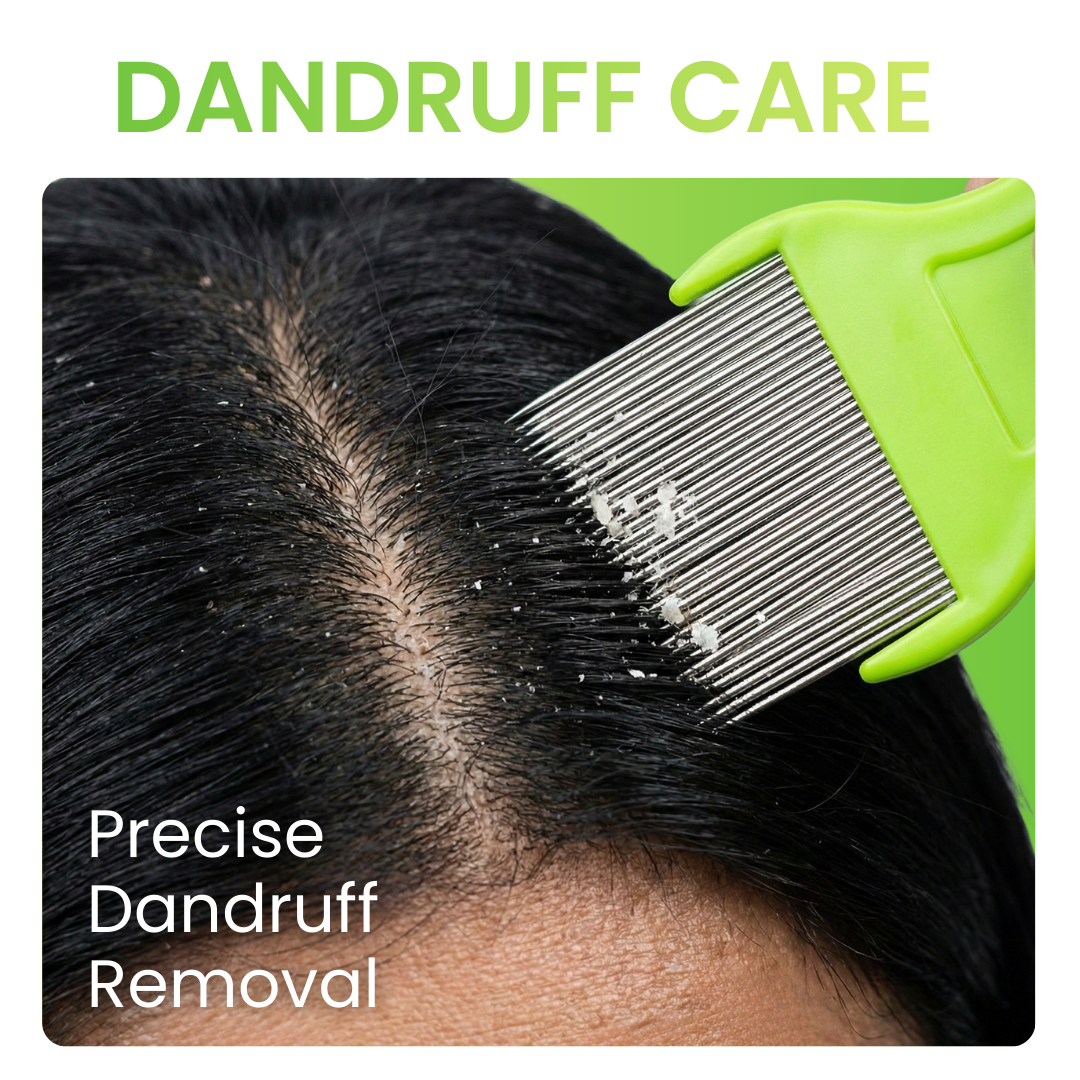 Natural Amla & Rosemary Anti-Dandruff Shampoo – No Parabens 100ml