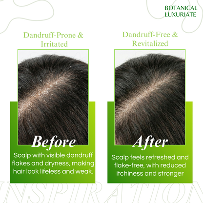 Natural Amla & Rosemary Anti-Dandruff Shampoo – No Parabens, 100ml