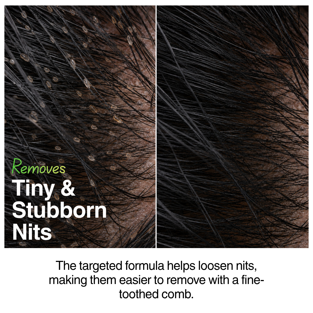 Natural Tea Tree Anti Lice & Nits Shampoo 100ml