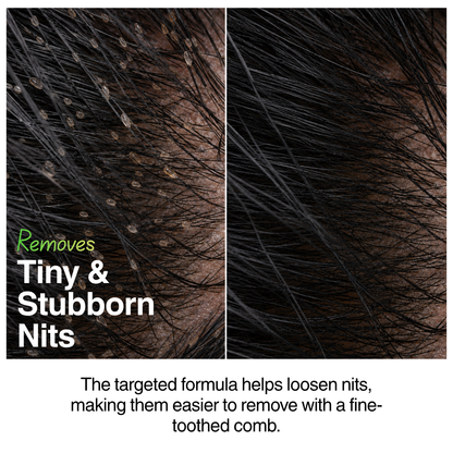 Natural Tea Tree Anti Lice & Nits Shampoo 100ml