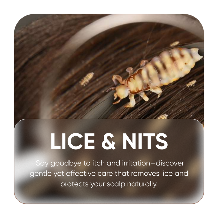 Lice & Nits
